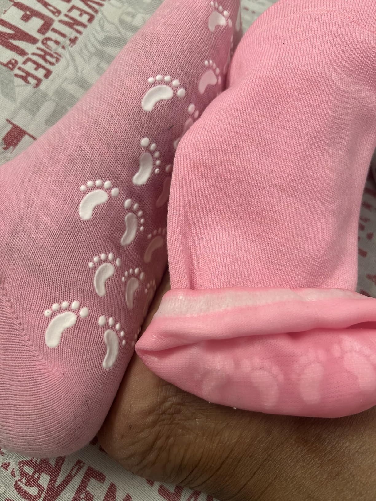 Gel socks customer result